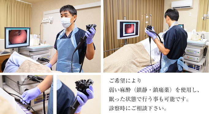 内視鏡検査